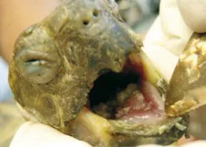 Herpes