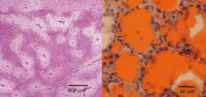 Histologischer Schnitt der Leber aus Abb. 18