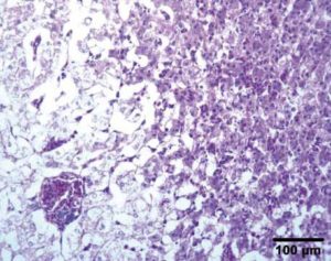 Ausschnitt um ein periportales Feld herum mit geschädigtem (links) und nicht geschädigtem (rechts) Lebergewebe. Färbung: Hämalaun-Eosin-Phloxin.