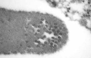 Eine elektronenmikroskopische Aufnahme, die Viruspartikel (kleine schwarze Rosetten) im Zytoplasma eines Erythrozyten einer Testudo marginata mit virusinduzierter Panzerröte zeigt. Das Blut dieses Tieres wurde übrigens nach veterinärmedizinischer Unter-suchung als „Virus negativ“