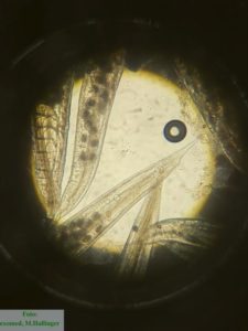 Wurmkur: Fünf Adulte, trächtige Oxyuriden unter dem Mikroskop (Uterus mit Wurmeiern gefüllt)